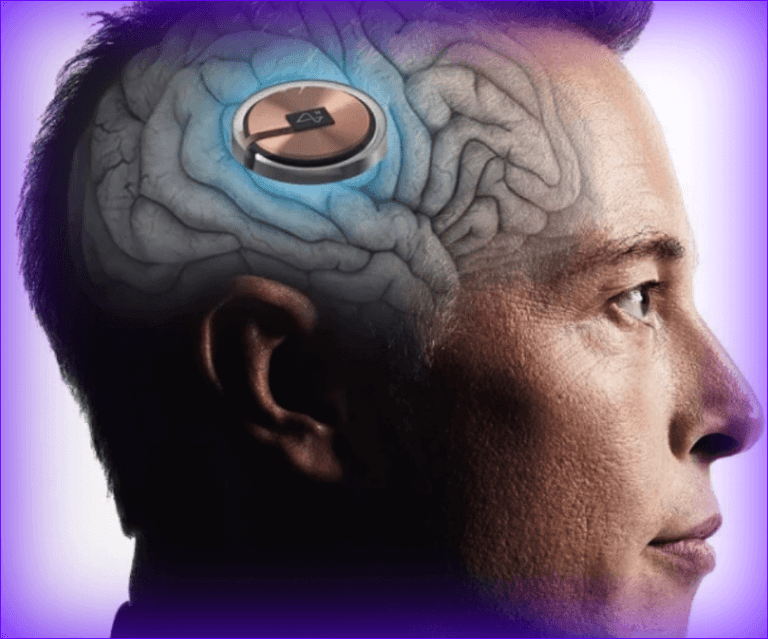 nevrologichni-implanti-na-musk-detelina-bonuses